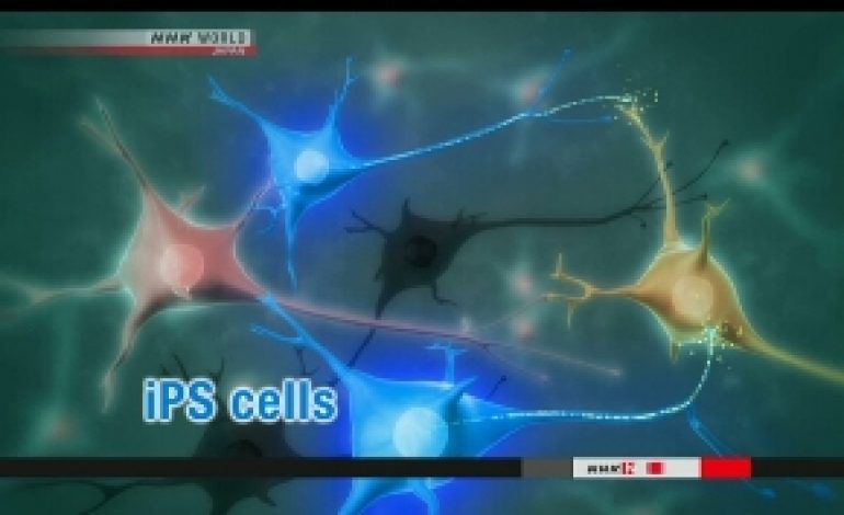 Transplantasi Sel Punca Otak IPS Pertama