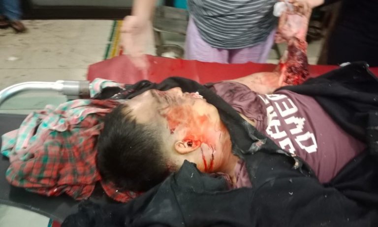 Terlindas Tronton, Warga Indrapura Tewas Ditempat