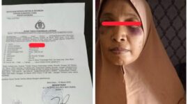Dibogem Suami, Istri Lapor Polisi
