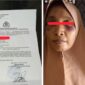 Dibogem Suami, Istri Lapor Polisi